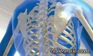 از پوکی استخوان جلوگیری کنید
