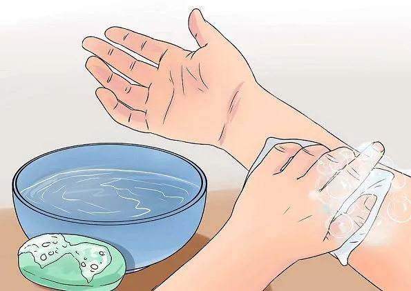 مراقبت از چسب جراحی