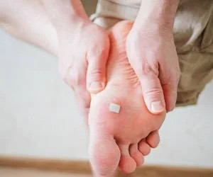 میخچه