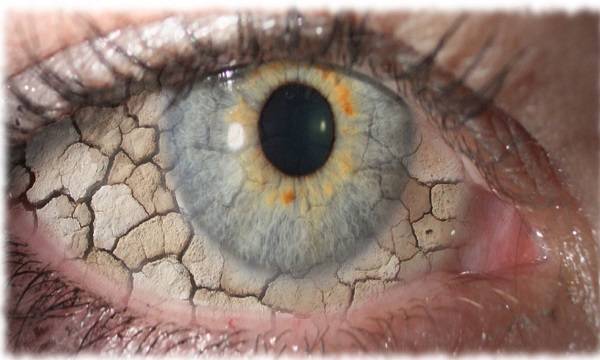 ترشحات چشمی و عواملی که باعث عفونت چشم می شود