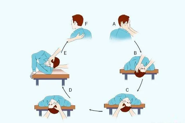 مانور اپلی