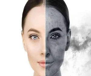 آلودگی هوا و پوست