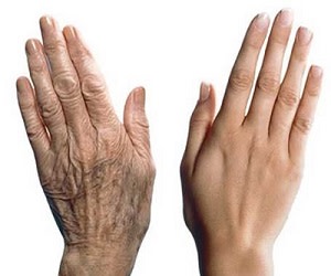 جوانی پوست دست