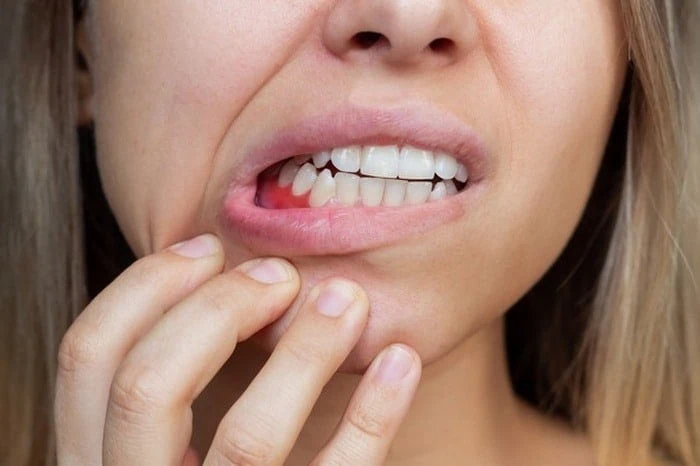 عوارض مسواک نزدن