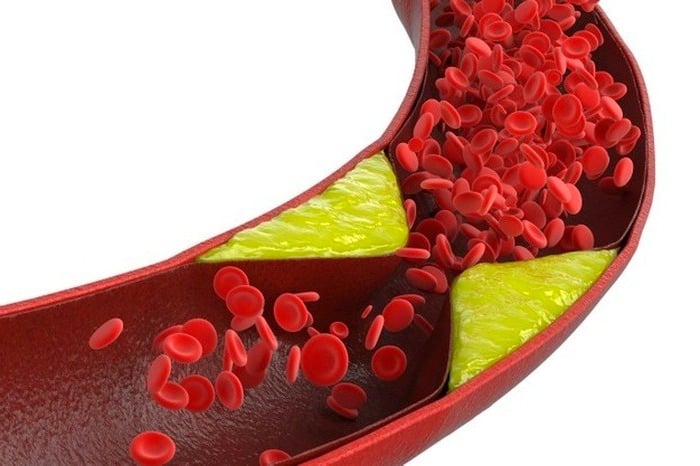 مقدار مناسب چربی خون چربی خون