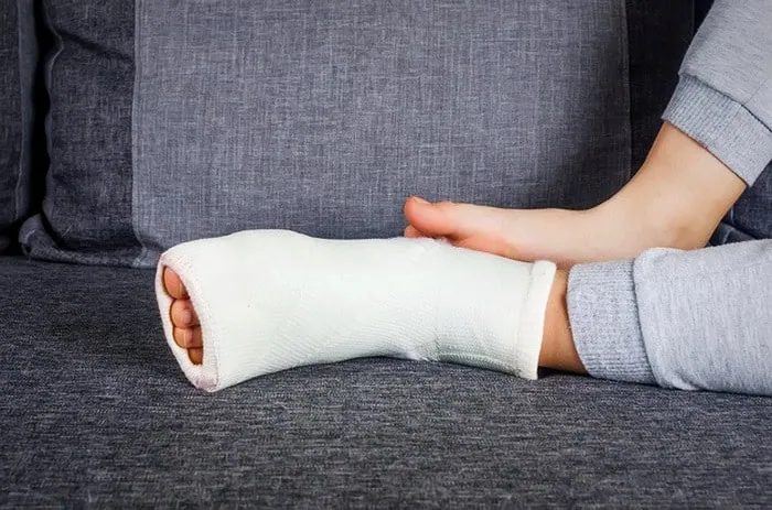 خونریزی از عوارض شکستگی استخوان خونریزی