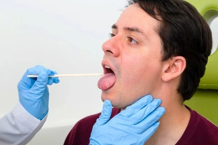 درمان گزگز نوک زبان