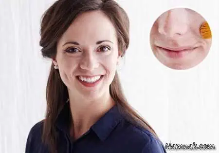 آرایش جای زخم و جوش