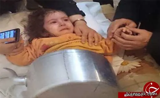 گیرافتادن در کتری
