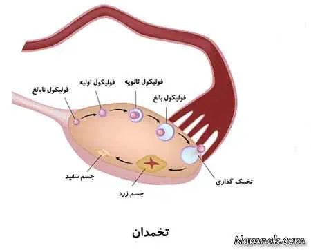 بیماری پیچ خوردگی تخمدان