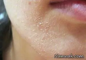 درخواست های بدن