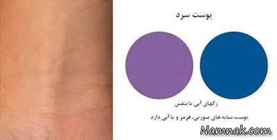 رنگ پوست
