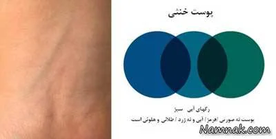 رنگ پوست