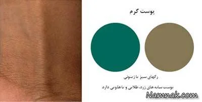 رنگ پوست