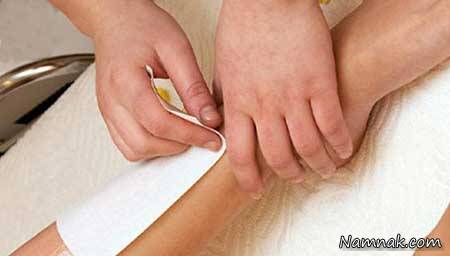 جوش های بعد از اپیلاسیون