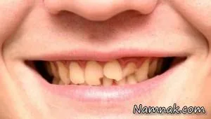 دندان