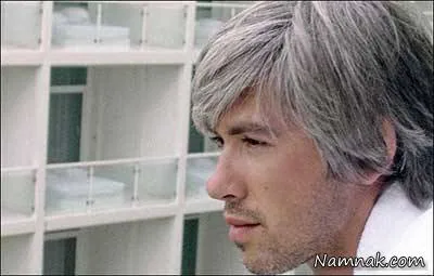 سفید شدن مو