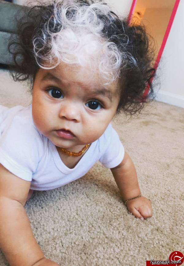 نوزادی با موی سفید