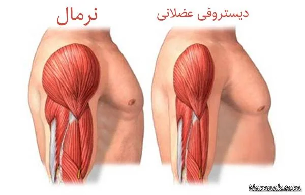 بیماری های نادر 