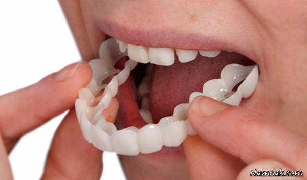 پروتز دندان متحرک 