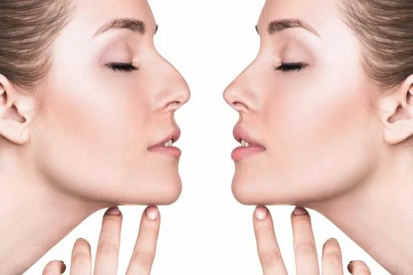 اصول مهم مراقبت بعد از عمل جراحی بینی