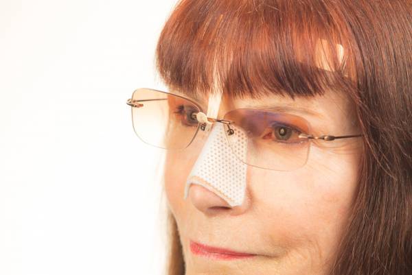 عینک زدن بعد از عمل بینی