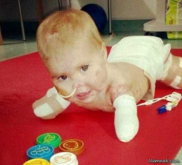 عکس کودک بدون دست و پا