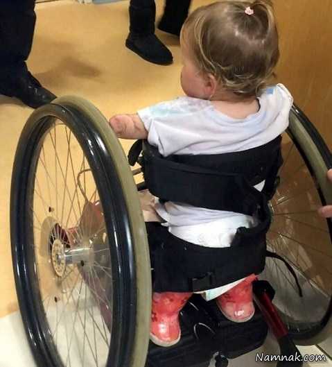 کودک معلول