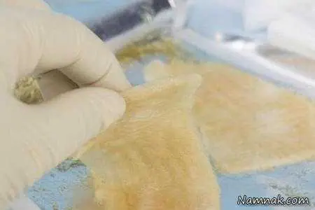 ژل متوقف کننده خونریزی