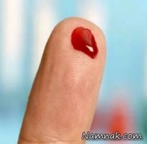 لخته شدن خون