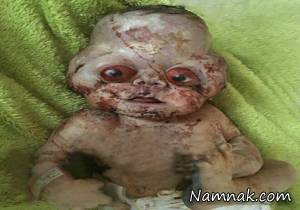 تولد نوزاد عجیب با چشمانی قرمز در مازندران؟! + عکس