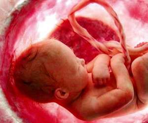 قصاص سقط جنین