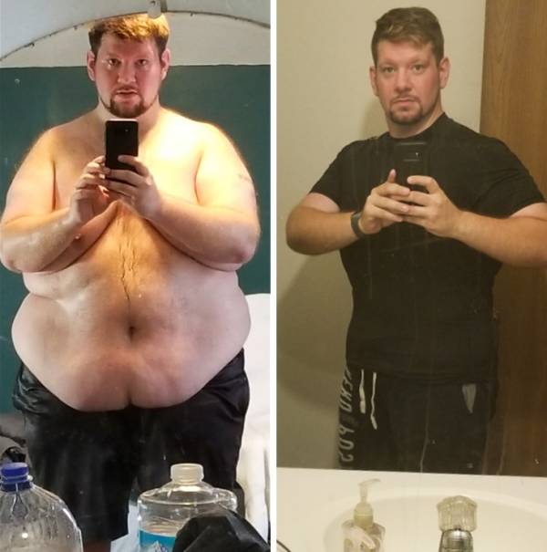 قبل و بعد از کاهش وزن