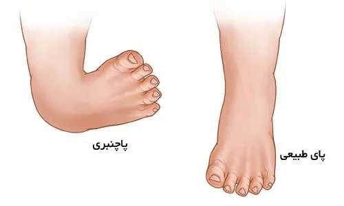 علایم پاچنبری