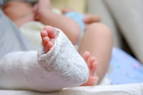 گچ گیری پاچنبری