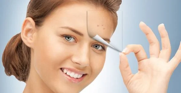 خال های پیشانی