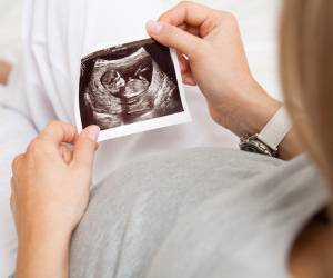 تشخیص جنسیت جنین با سونوگرافی در چند هفتگی