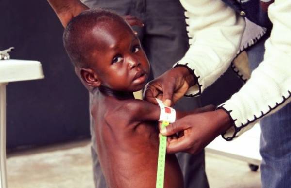 سوء تغذیه در کشورهای فقیر