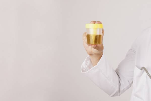 نمونه برداری از ادرار