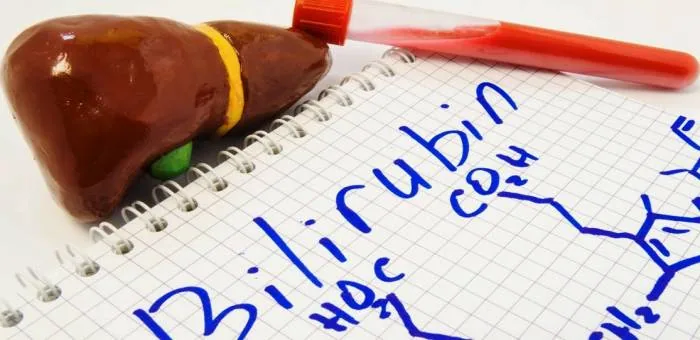 بیلی روبین