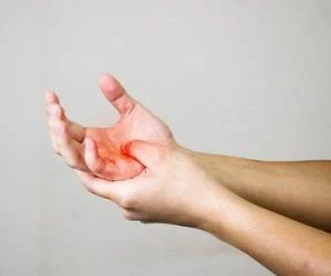 فیبرومیالژیا