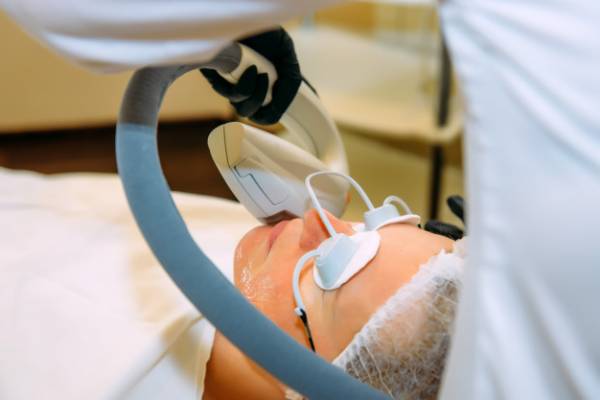 لیزر واریس صورت