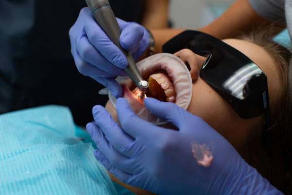 روش لیزر دندانپزشکی