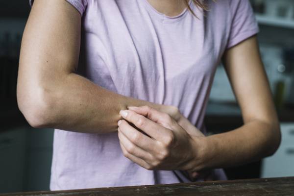 خارش پوست از عوارض پنتوپرازول کهیر و خارش پوست