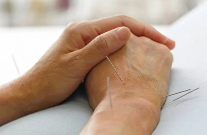 عوارض طب سوزنی در بارداری خطرات طب سوزنی در بارداری