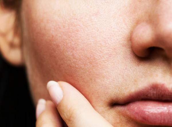 کاهش منافذ پوستی