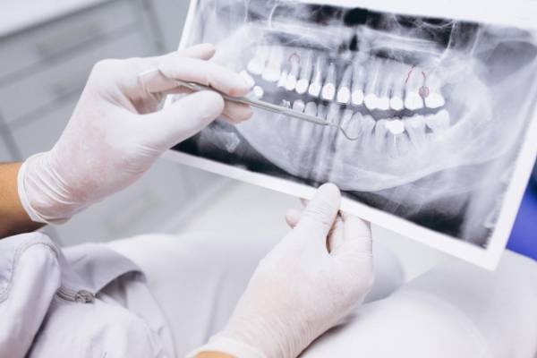 تست تشخیصی دندان