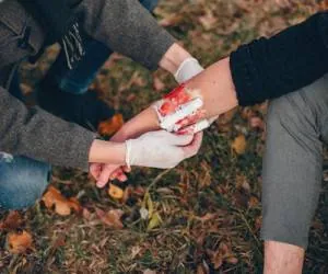 مراقبت از زخم باز