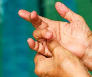 انگشت ماشه ای