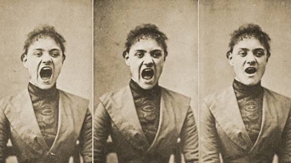 تاریخچه هیستری